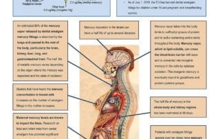 Dental Amalgam Mercury Exposure and Human Health Risks Throughout the Life Span