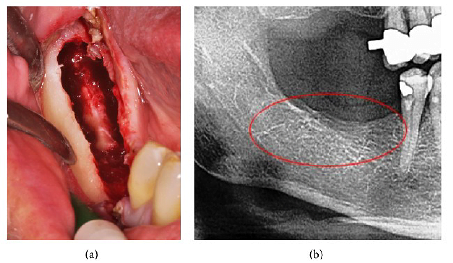 A close-up of a person's teeth Description automatically generated