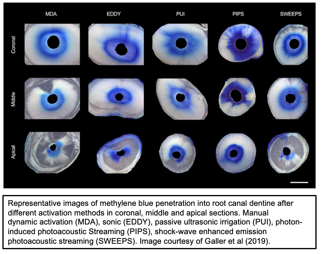 A collage of images of blue eyeballs AI-generated content may be incorrect.