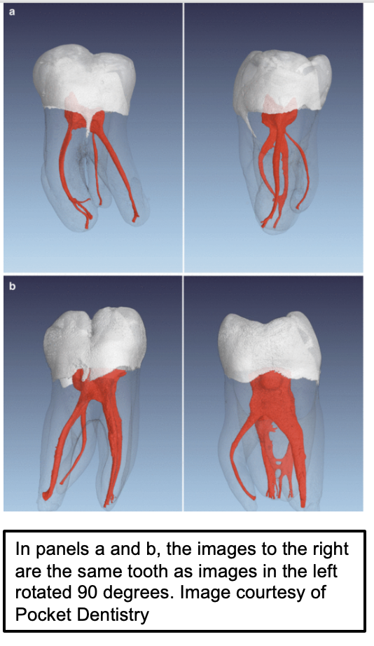 A collage of images of human teeth AI-generated content may be incorrect.