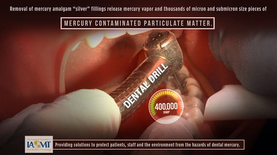 mercury vapor and particles during removal