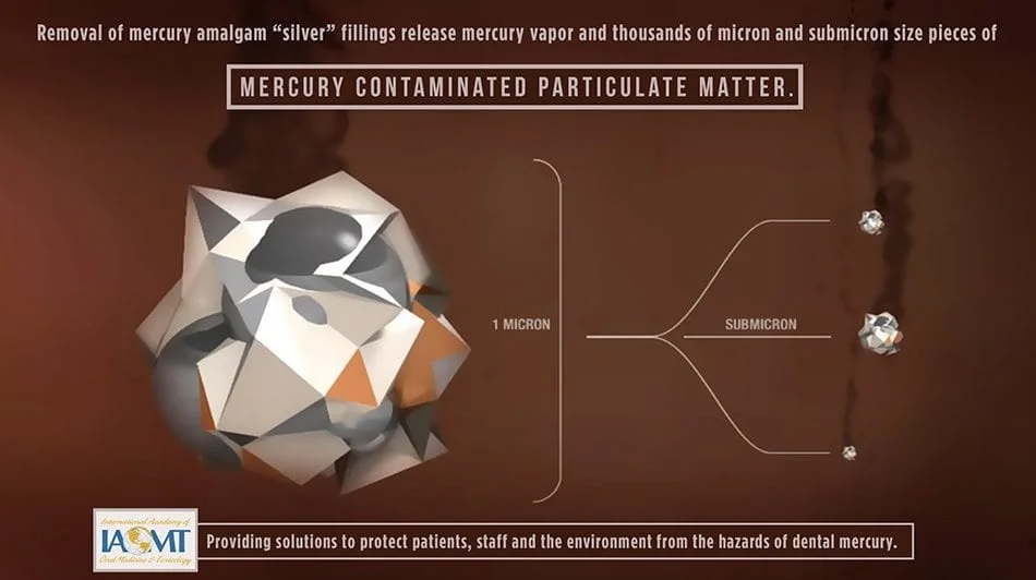 dental mercury contaminated particulate matter